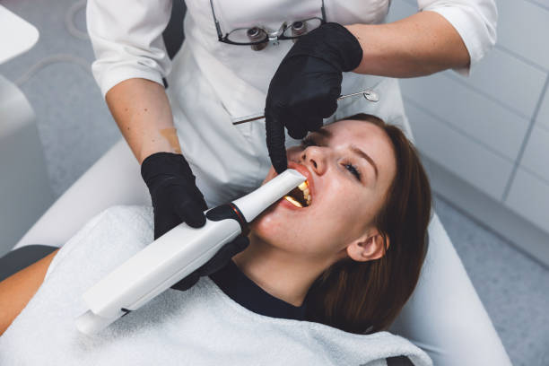 Best Emergency Dental Care for Broken or Chipped Teeth in Poway, CA